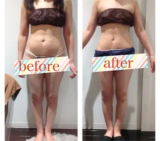 脱毛フェイシャル痩身 エリア最安👑永野舞のエステ・リラクイメージ