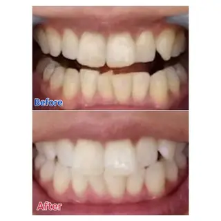 MBEAUTYSALON 千葉店・京成大久保所属・Melty 輝のその他イメージ