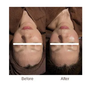 肌管理専門！BACI 加盟店LUANAのエステ・リラクイメージ