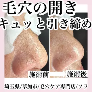 毛穴専門店hula 杉山智美のエステ・リラクイメージ