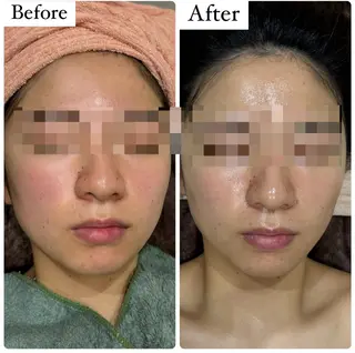 ハーブピーリング専門 muro.のエステ・リラクイメージ