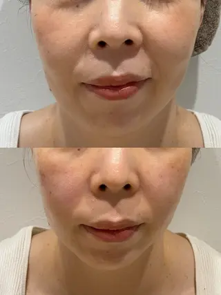 Hair&Spa リーノ所属・折原 あやのエステ・リラクイメージ