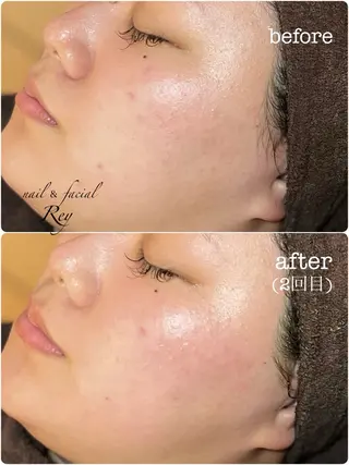 R eyのネイルデザイン