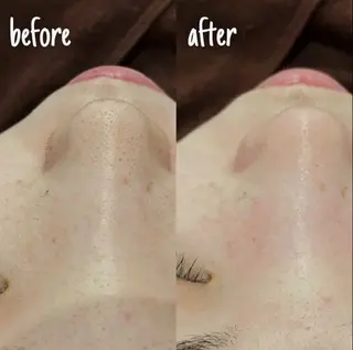 Beauty bar KOA所属・Beauty bar KOAのエステ・リラクイメージ