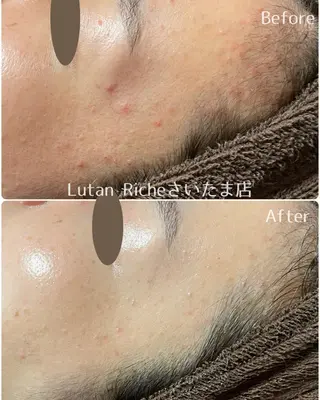 Lutan Richeさいたま店所属・ルタンリッシュ さいたま店のエステ・リラクイメージ