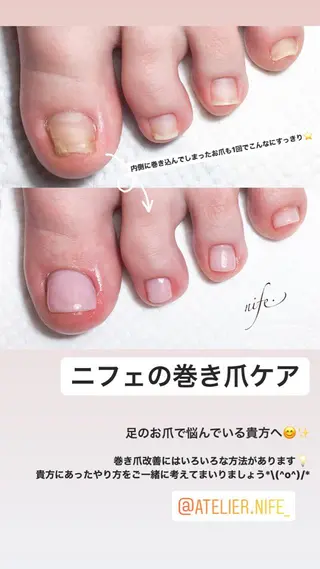 ネイル atelier nife.のネイルデザイン