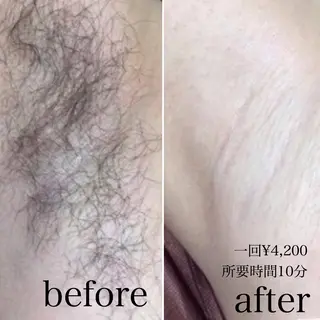 calon hair所属・men's calonのエステ・リラクイメージ