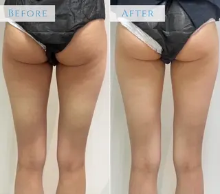 レセラ銀座所属・レセラ 銀座のエステ・リラクイメージ