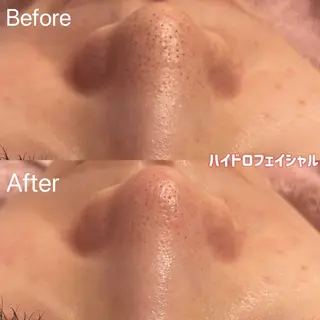 アイラッシュ&エステサロンLinda西宮所属・小顔&毛穴・肌質改善 LINDA西宮 AIのエステ・リラクイメージ