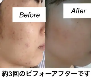 都度払い肌質改善 &脱毛Blancheのエステ・リラクイメージ