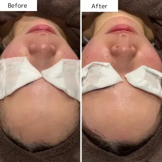 Beauty  salon Lien所属・大村市Lien＊ 中川内翔子のエステ・リラクイメージ