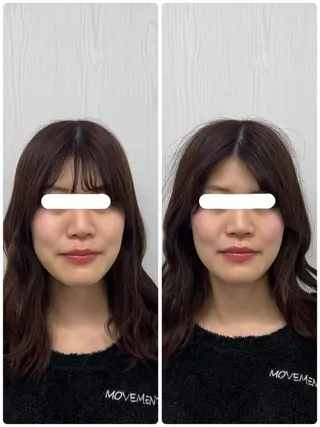 美容鍼×小顔矯正 ×美容整体　浜川泰仁のエステ・リラクイメージ