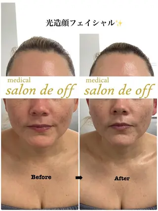 🩵Tatsumi Kana🩵のエステ・リラクイメージ