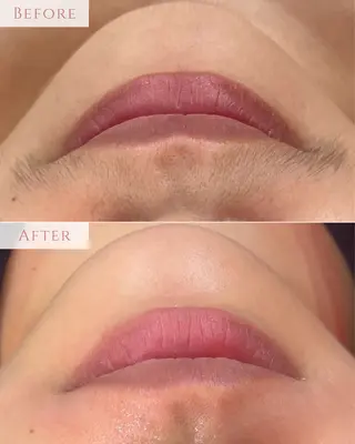 肌質改善専門サロン Bellmi/心斎橋のエステ・リラクイメージ