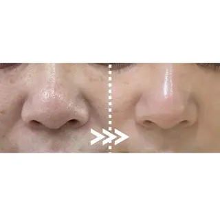 肌質改善専門 ハーブ /毛穴洗浄 リエイトのエステ・リラクイメージ