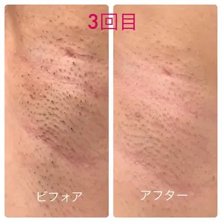 毛穴レス ハーブ＆ ワックス脱毛×光脱毛のエステ・リラクイメージ