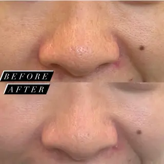 小顔、リフトアップ Lumière所属・小顔・美肌 ルミエールのエステ・リラクイメージ