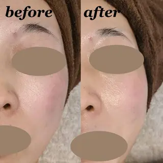 total beauty DIAのネイルデザイン