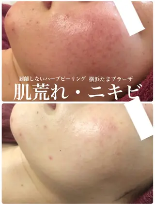 LILIANA所属・LILIANA ☆YURIのエステ・リラクイメージ