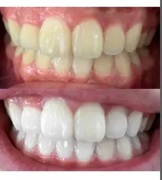 エクシアホワイト 立川南口のエステ・リラクイメージ