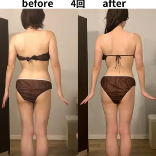 小顔・痩身専門店 Sunao所属・小顔.足痩せ整体 痩身天六Sunaoのその他イメージ