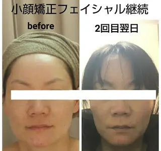 小顔と美肌 まごころエステMatoria所属・小顔 美肌専門 Matoriaのエステ・リラクイメージ