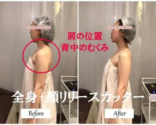 ブライダルサロン ｜Lino【堀江】のエステ・リラクイメージ