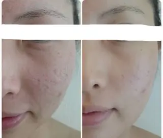 bonuru salonのエステ・リラクイメージ