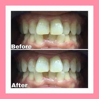 Briller 浜松のエステ・リラクイメージ