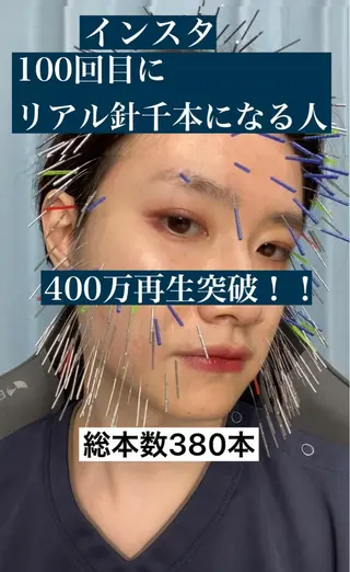 美容鍼・小顔矯正 ハリシェンドのエステ・リラクイメージ