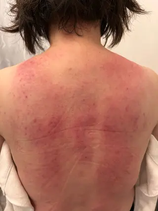 ドライヘッドスパ KilaKilaのエステ・リラクイメージ