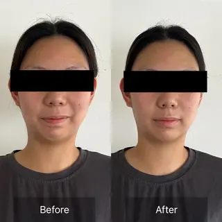 Radiance H.Oのエステ・リラクイメージ