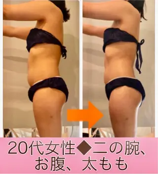 ロング カラー パーマ ヘアアレンジ メンズ キッズ ネイル マツエク・マツパ ‍痩身＆ボディ 結果出し🌟丹野のエステ・リラクイメージ