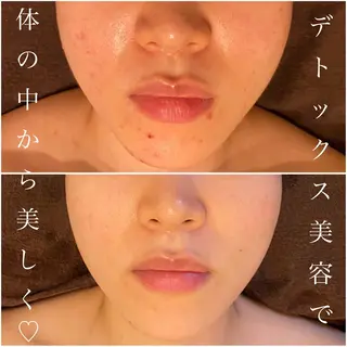 ダイエット・美肌ケア fleurのエステ・リラクイメージ