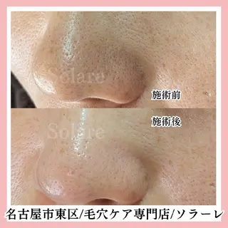  毛穴洗浄・まつ毛 の専門店 ソラーレのエステ・リラクイメージ