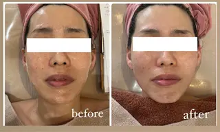 RAY Beauty エステ　一宮店のエステ・リラクイメージ