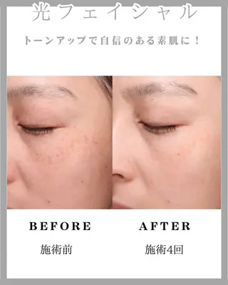 SHINE💫 山口のその他イメージ