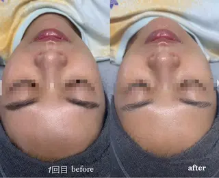 Lily 竹前のネイルデザイン