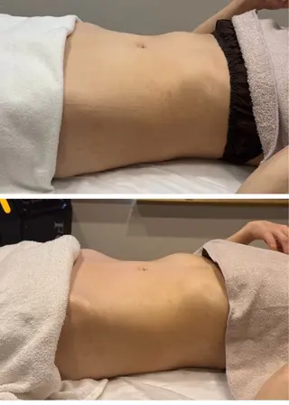 美肌脱毛サロン muroのエステ・リラクイメージ