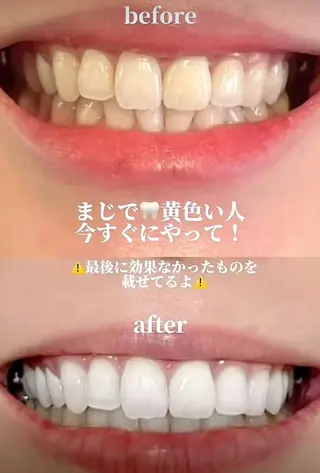 SG アイラッシュ ラッシュリフトのその他イメージ