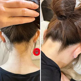 うなじ脱毛/美肌脱毛 LABELのエステ・リラクイメージ