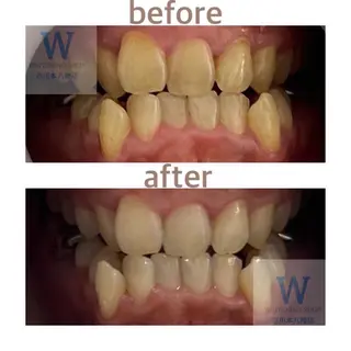 ホワイトニング ショップ本八幡店のエステ・リラクイメージ