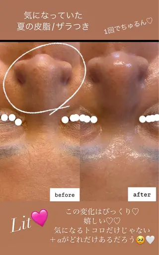 Lapis maikaのエステ・リラクイメージ