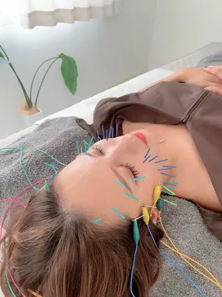 美容鍼＆鍼灸サロン 鍼Glitter.所属・田中 美奈のエステ・リラクイメージ