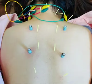 美容鍼灸サロン mahoroba院長のエステ・リラクイメージ