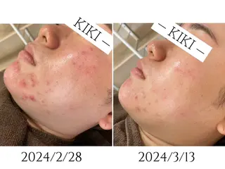 ハーブピーリング綺肌銀座店所属・ハーブピーリング綺肌 KIKI銀座店のエステ・リラクイメージ