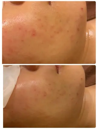 ビューティーラウンジ A&A✨佐藤✨のエステ・リラクイメージ