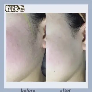 レイビス 🌻仙台🌻吉村のエステ・リラクイメージ