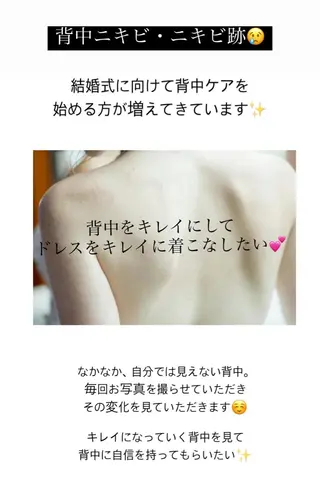 ベラージュ【美背中・ 美尻・フェイシャル】のエステ・リラクイメージ