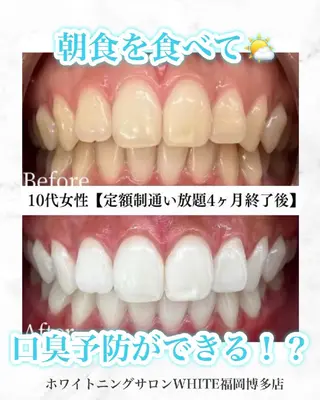 キッズ メンズ ホワイトニングサロン WHITE福岡博多店のエステ・リラクイメージ